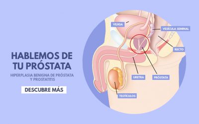 Prostatitis